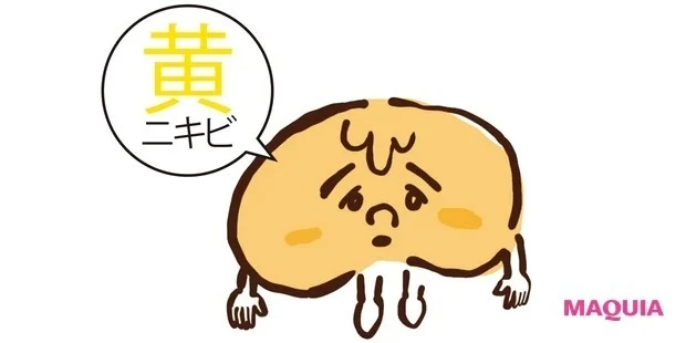 黄ニキビとは