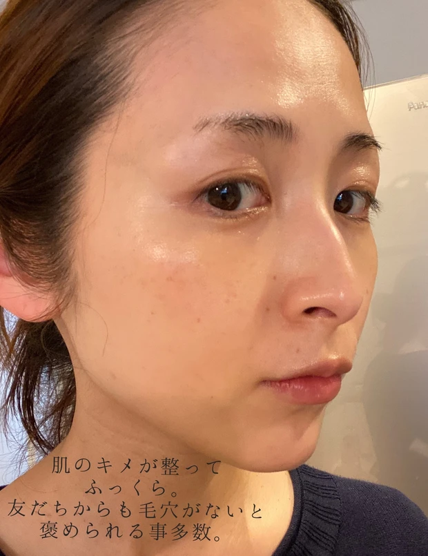 ヒト幹細胞培養エキス原液でハリやたるみの悩みに立ち向かえ！！アラサー母ブロガーおすすめのエイジングケアアイテム_4