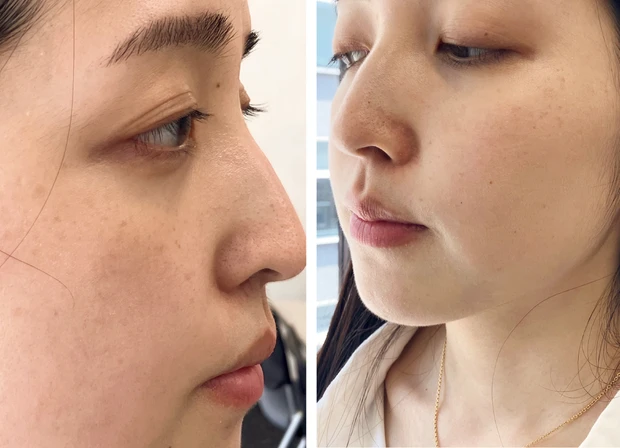 マキア　毛穴ケア　乾燥肌