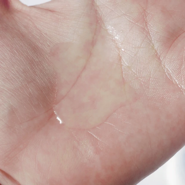 敏感肌の味方”イハダ”から美白ライン登場！お肌弱々アラサー女子が実際に使ってみた_3_1