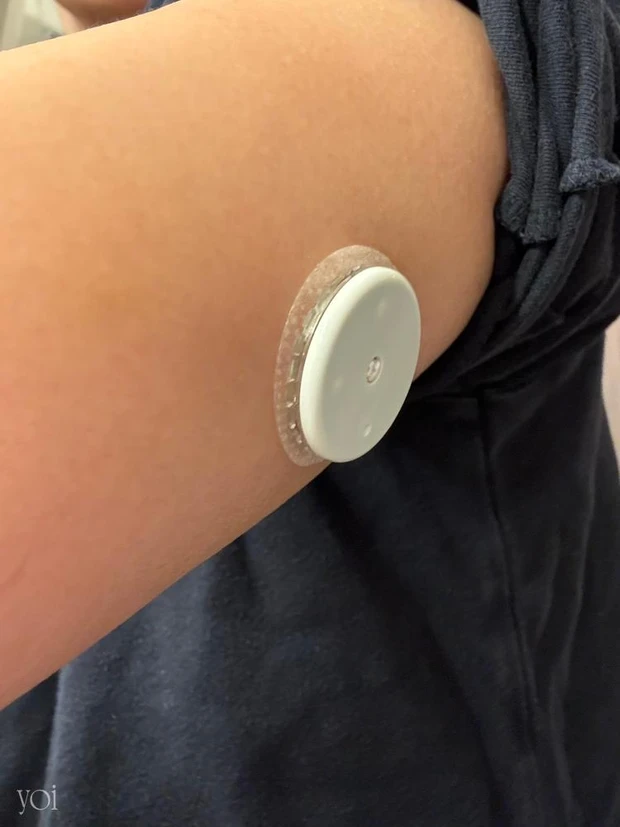 持続血糖測定器　FreeStyleリブレ2　センサー　腕に装着　実際に試してみた