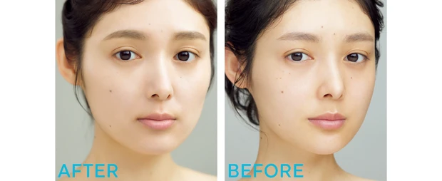 エトヴォス ミネラルインナートリートメントベース ビフォーアフター