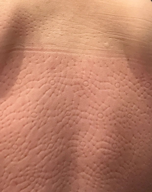 シャクティマットに20分寝転んだ後の背中🔥