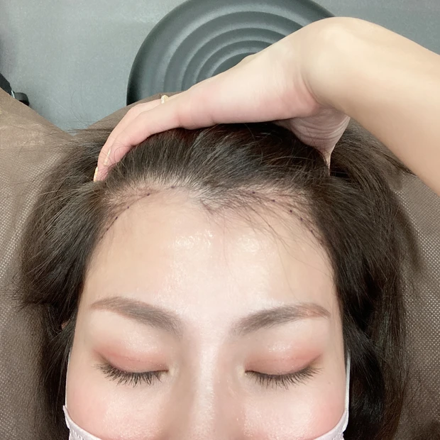 施術動画あり!ヘアラインアートメイクって知ってる?生え際のアートメイクとっても気に入ったのでレビューします!
_3_3