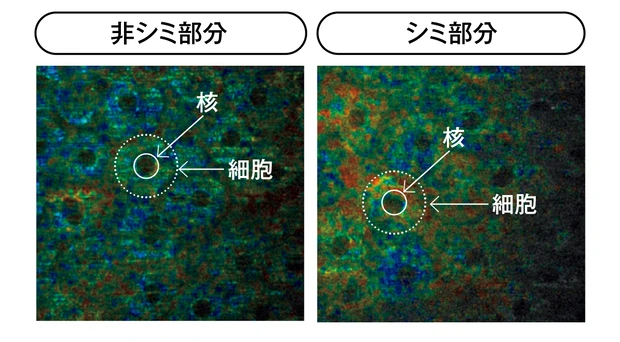 細胞老化がブライトニングの新しいカギ