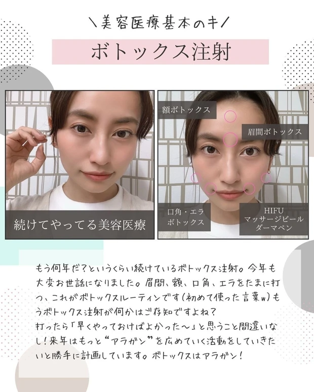 【2021年総まとめ】今年受けた美容医療!徹底解説!_4_1