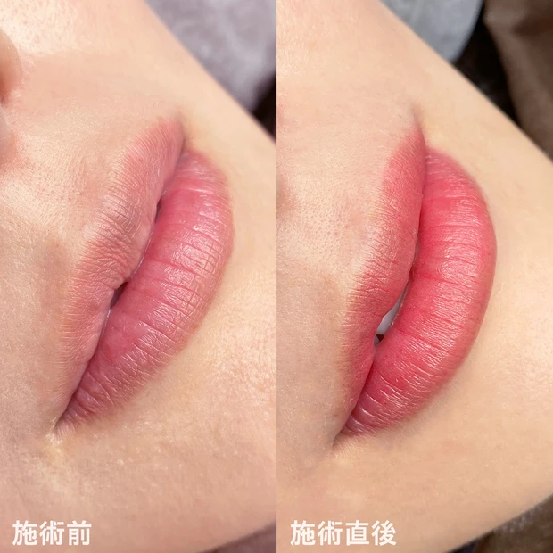 アートメイク リップ Kimiさん