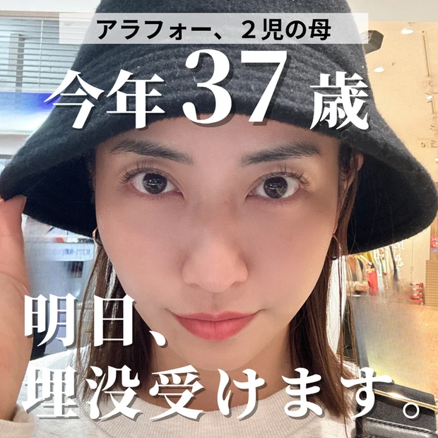 【2位】アラフォーの瞼の窪み&たるみ悩み!埋没法で解決するのか?