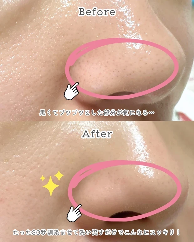 コスメデコルテ AQ 毛穴美容液オイル 口コミ