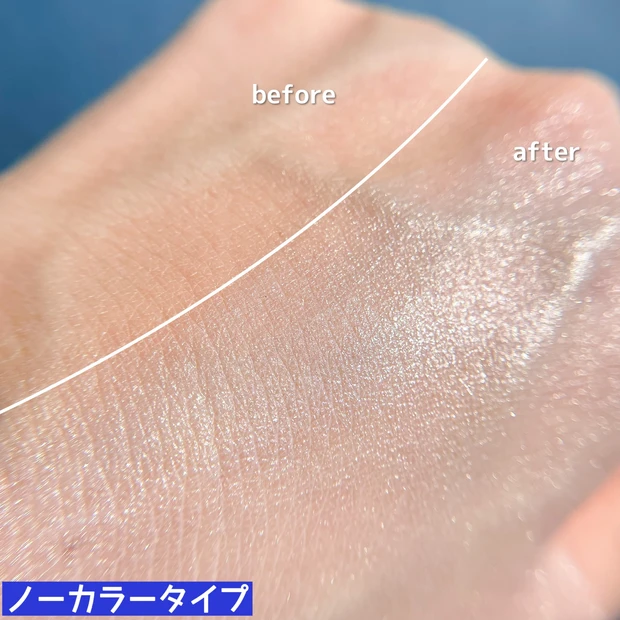 【深刻な敏感症状に】皮膚の専門家監修のお守り保護バームがおすすめ！_6_1