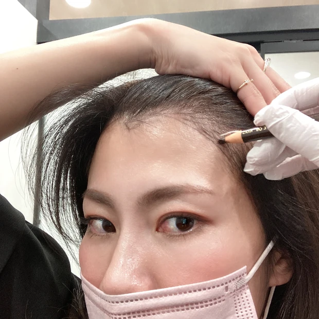 施術動画あり!ヘアラインアートメイクって知ってる?生え際のアートメイクとっても気に入ったのでレビューします!
_3_1