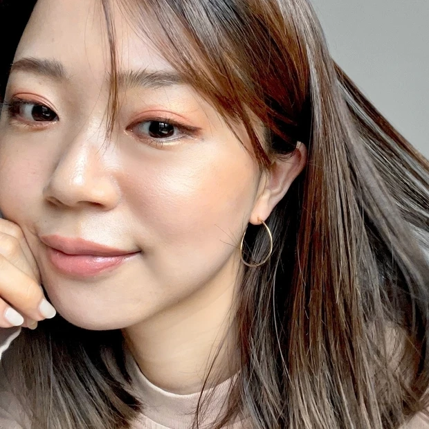 【ご当地美容】上海のヨセミテクリニックでM22(IPL治療)を受けてみた！6回コースでシミそばかすに効果あり！_10_2