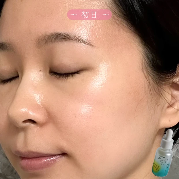 ソフィーナip 角層トーニングセラム1日目 使用初日の肌状態|くすみと色ムラが気になる状態