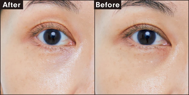 米肌 つやしずく スキンケアコンシーラー 02 カバー力を検証