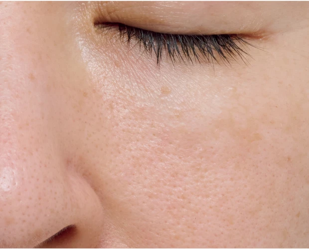 【悩み別】毛穴を目立たなくする方法 PhotoGallery_1_28