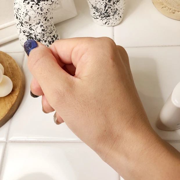 【緊急！】秋の3大肌トラブル"大人ニキビ、乾燥肌、敏感肌" イニクスでお救い作戦！_3_1