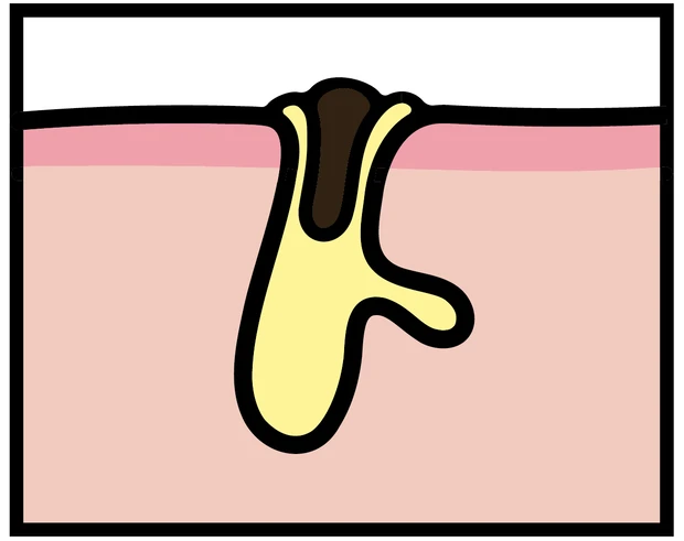 【悩み別】毛穴を目立たなくする方法 PhotoGallery_1_4