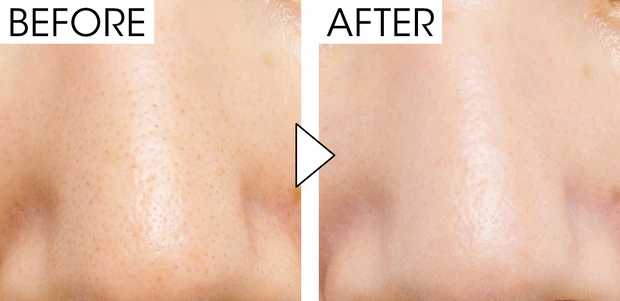 マキア　毛穴ケア　おすすめ　エスト　ジェリオロジー プライマー M