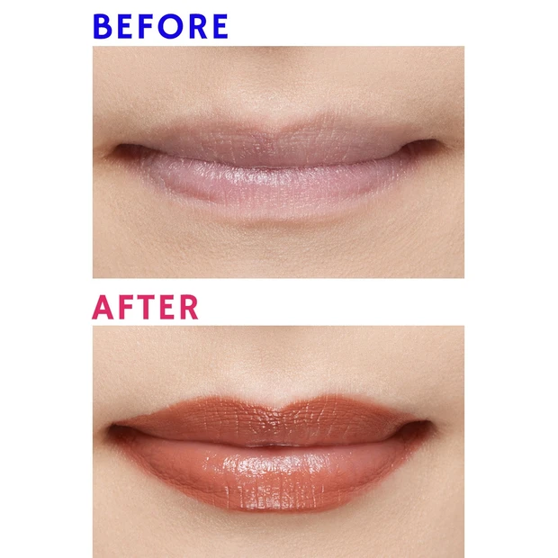 【悩み】唇が薄く、ボリュームがない