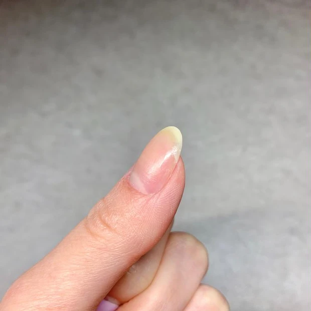 セルフネイル 自爪 亀裂 亀裂対処法 ネイルケア 爪補強