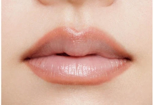 欲張りオーバーリップ AFTER