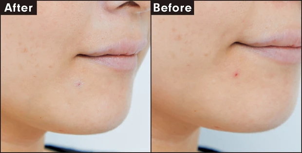 ジバンシイ プリズム・リーブル・スキンケアリング・コレクター ブルー カバー力を検証