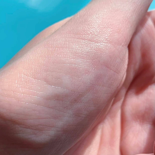 ピリピリしがちなビタミンC美容液。その中でも濃厚なオバジNEO!沁みないおすすめの使い方_2_3