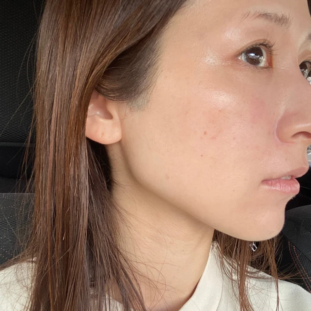 DT中のノーファンデ肌におすすめの愛用アイテム3選!無加工画像でリアルにお届けします!