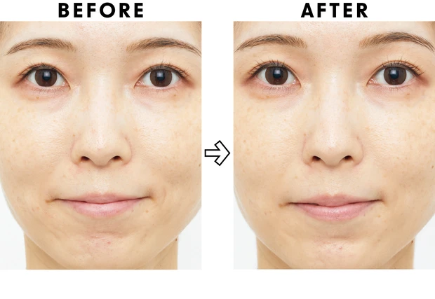 高額スキンケアの効果は？ ベスコス受賞コスメを2週間お試し PhotoGallery_1_7