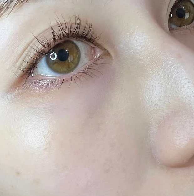 【美白ケア】最新美白スキンケア情報！話題の高級美白美容液の実力とは？_2_3