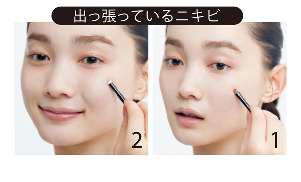 出っ張っているニキビ