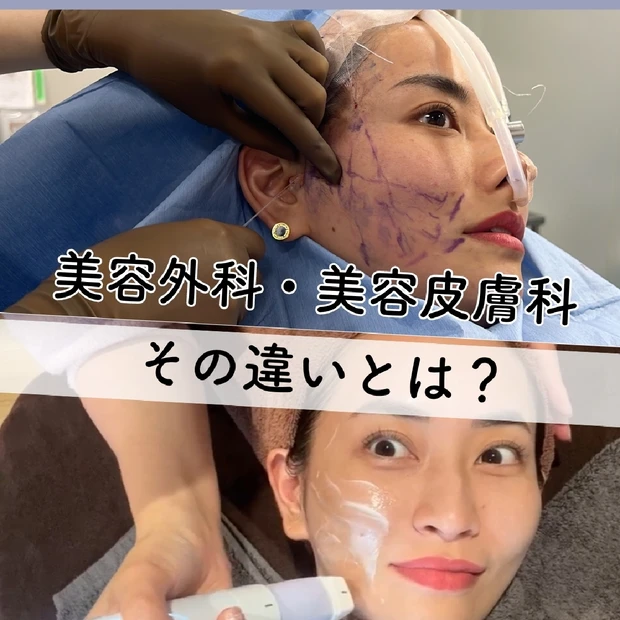 「美容皮膚科」と「美容外科」の違いについて解説します！