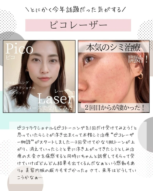 【2021年総まとめ】今年受けた美容医療!徹底解説!_7_1