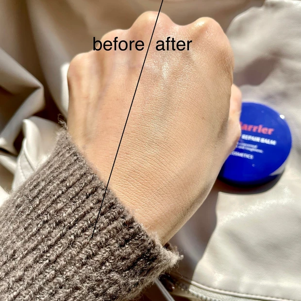 【皮膚専門家監修】肌をバリア＆プロテクト♡敏感症状の肌の”お守り保護バーム“【2/16発売】_7