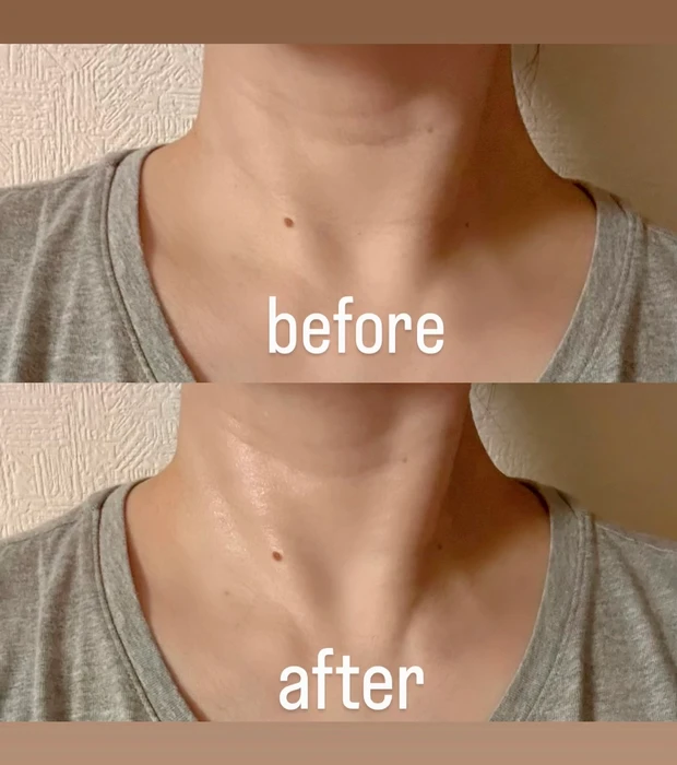 小田切ヒロさんも絶賛！首のシワ対策に！【メディピール】プレミアムネックスティック＆クリーム徹底レビュー_4