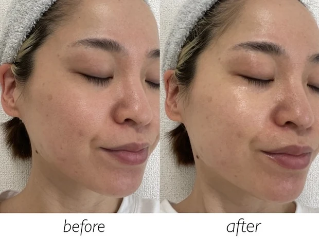 「アクアレーベル スペシャルジェルクリーム クール」ビフォーアフター