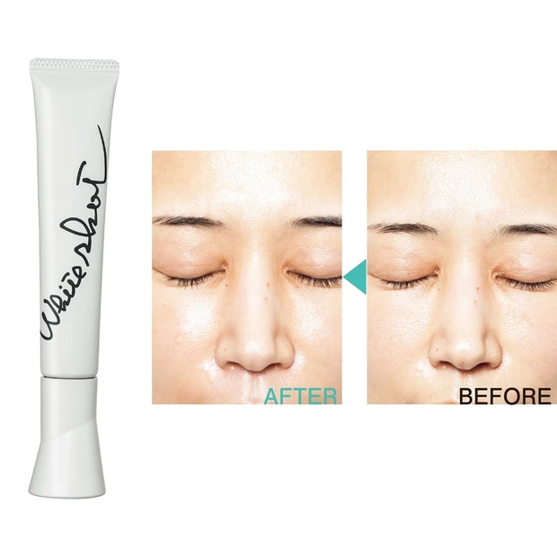 「ホワイトショットSXS」を本気で試してみた！ 18％改善でポイントケア…