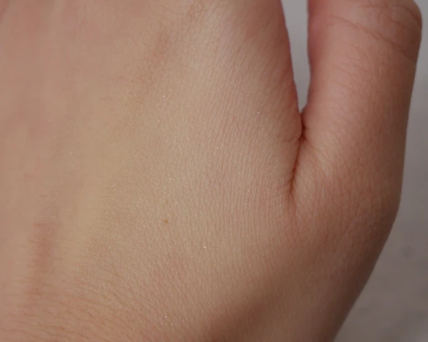 ポアレスフィクサー