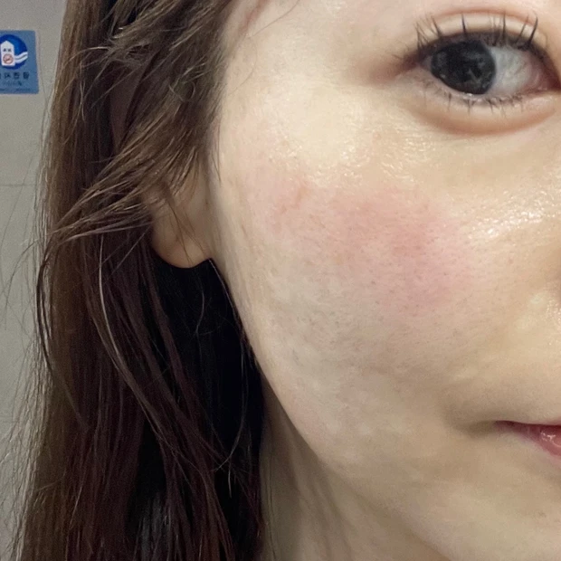 ジュベルック　毛穴