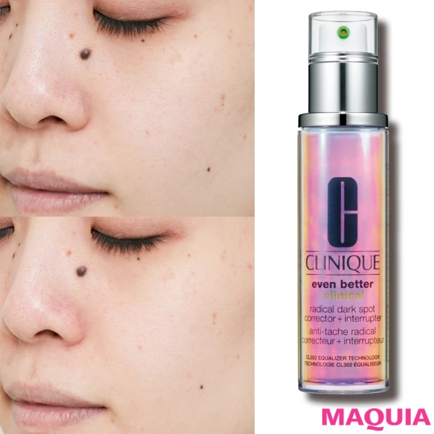 毛穴も沈着くすみも消えた!? 美白美容液クリニークのセラムをガチ試し