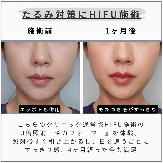 MAQUIAエキスパート MAQUIAブロガー talico