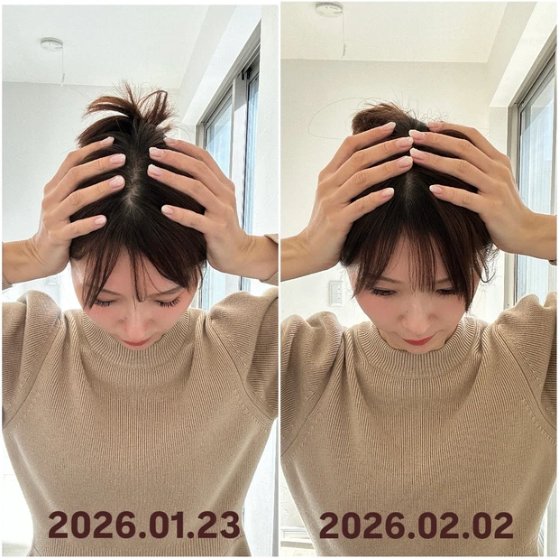 フェイスポインター待望の新作「 ホライゾン」が凄い！“頭コリ”にアプローチ。私の10日間の変化＜BA写真あり＞_3_3