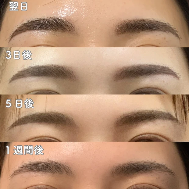 【必見】2024年やってよかった美容♡美容医療・ホームケア・美顔器、効果があったのはコレ！_3_1