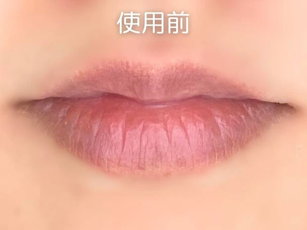 【トリデン リップ美容液 口コミ】ソリッドイン リップエッセンス