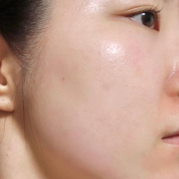 オバジC リファインローション　効果