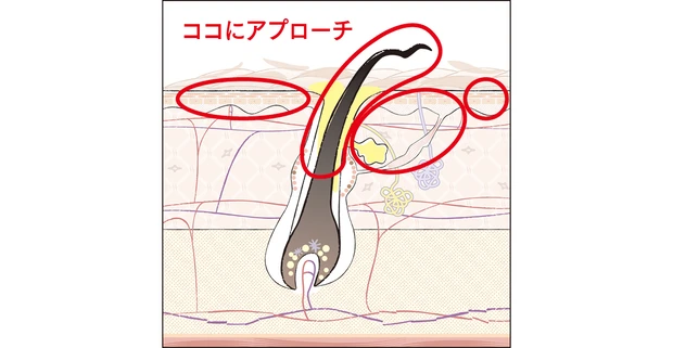 ココにアプローチ