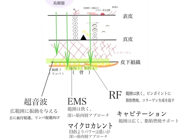 美顔器の特徴