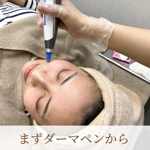 ダーマペン