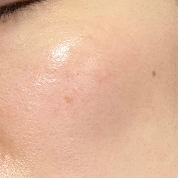 スポットシミケアを２種比較。できちゃったシミにも効くの？答えはYES!!_2_2