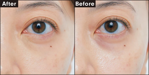 ジルスチュアート ダイヤモンドティップス コンシーラー C11 カバー力を検証